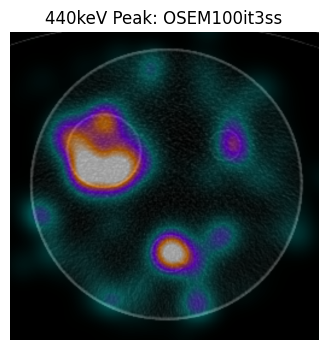 ../_images/notebooks_t_ac225_dicom_recon_22_0.png