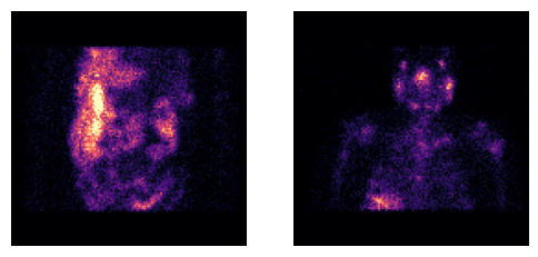 ../_images/notebooks_t_dicommultibed_12_0.png