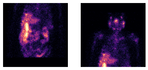 ../_images/notebooks_t_dicommultibed_14_0.png