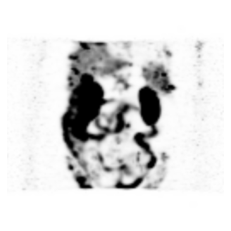 ../_images/notebooks_t_uncertainty_spect_12_0.png