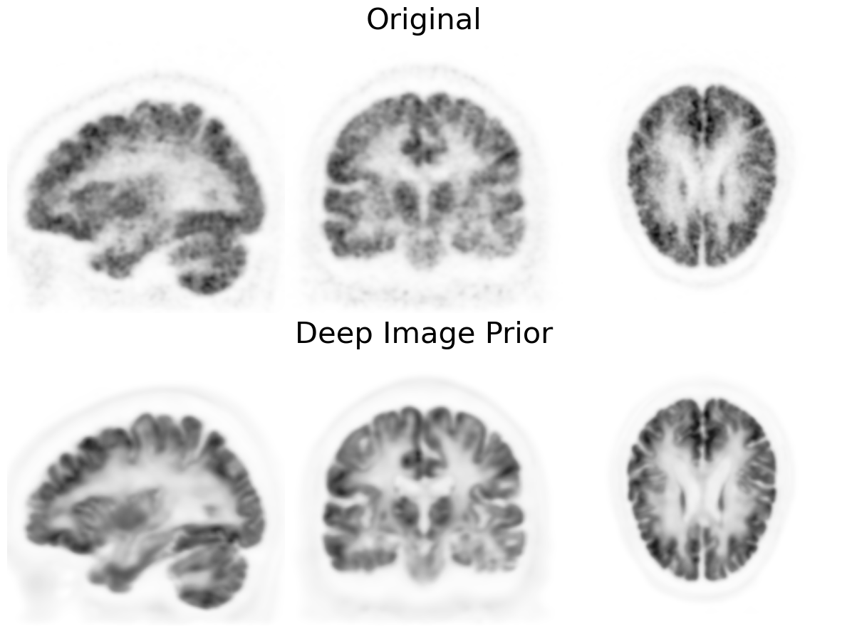 ../_images/notebooks_t_PETGATE_DIP_21_0.png