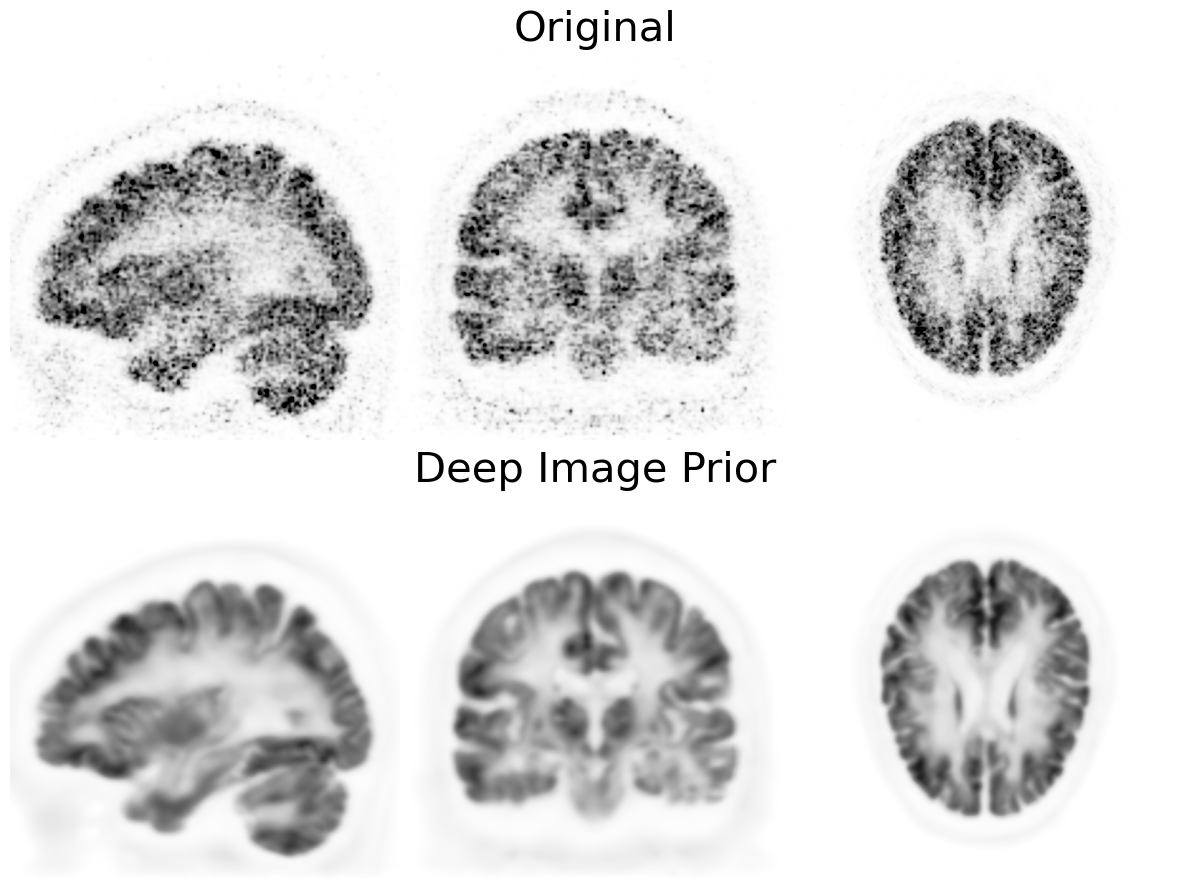 ../_images/notebooks_t_PETGATE_DIP_28_0.png