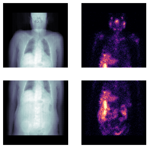 ../_images/notebooks_t_dicommultibed_16_1.png